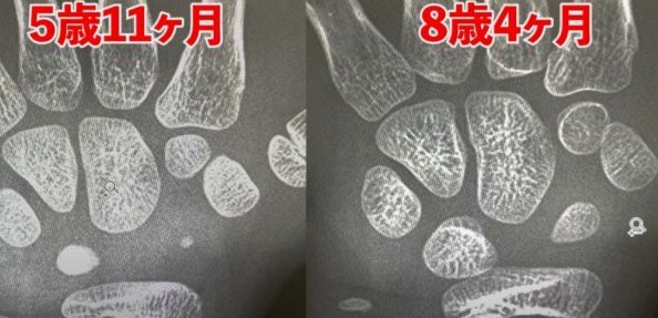 维尼修斯追平小罗世界杯进球纪录